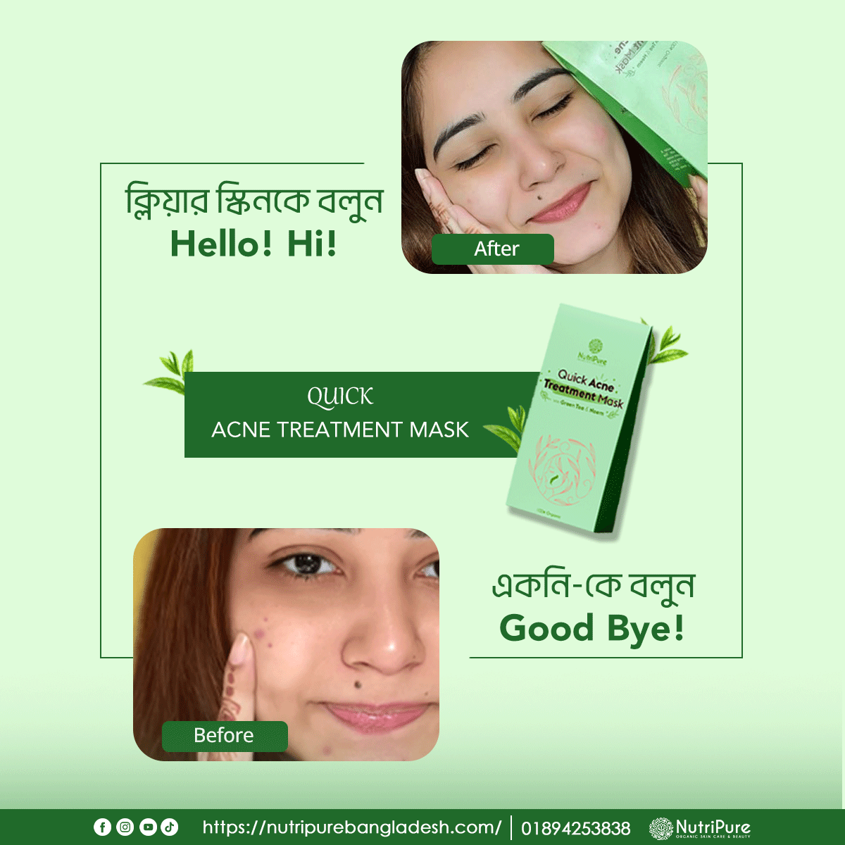 Quick Acne Treatment Mask My Store