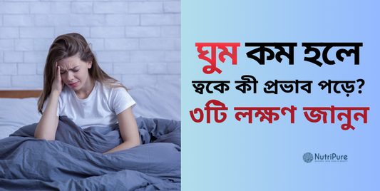 ঘুম কম হলে ত্বকে কী প্রভাব পড়ে? ৩টি লক্ষণ জানুন। How does lack of sleep affect your skin? Know 3 signs