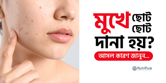 মুখে ছোট ছোট দানা কেন হয়? আসল কারণ জানুন What causes tiny bumps on your face
