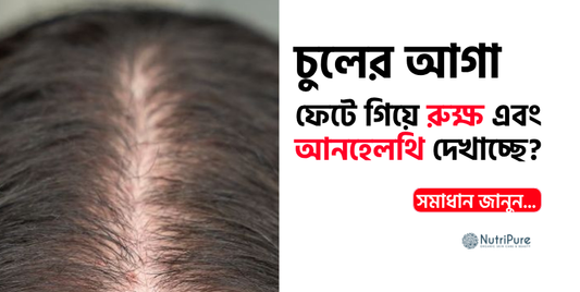 চুলের আগা ফেটে যাচ্ছে? কারণটা শুধু heat নয় Why your hair ends are splitting
