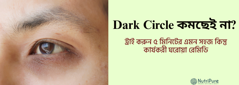 Dark Circle কমছেই না? ট্রাই করুন ৫ মিনিটের এই কার্যকরী ঘরোয়া রেমিডি। Dark circles aren't fading? Try this 5-minute effective home remedy.