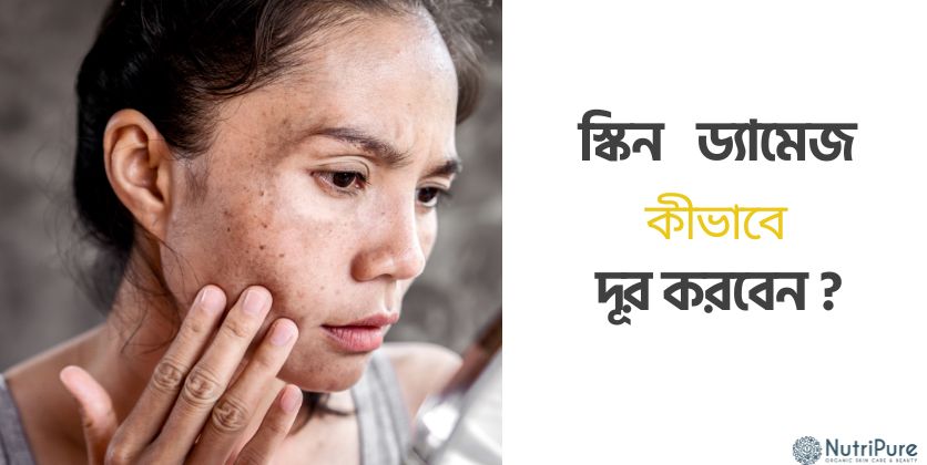 "২০-২৫ বছরে করা এই ভুলগুলোই স্কিন ড্যামেজের মূল কারণ! বাঁচতে সমাধান দেখুন কমেন্টে।"