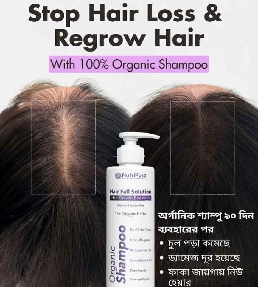 Derma Certified Organic Shampoo For Hair Fall, Damage & Hair Growth | 300ml