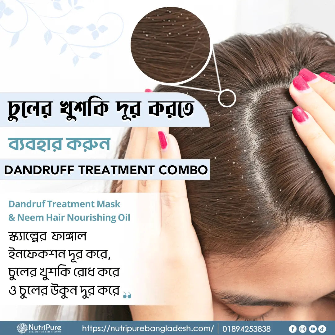 Dandruff Treatment (3 in 1 Combo) My Store